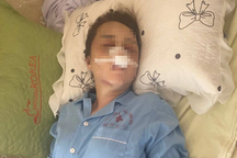 Giám định thương tật người phụ nữ bị cán bộ QLTT đánh đập vì ghen