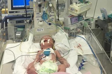 Ngoạn mục ca đặt máy tạo nhịp tim cho trẻ vừa chào đời