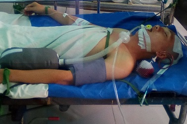 Tai nạn khó tin khi nằm võng ngày mùng 3 Tết