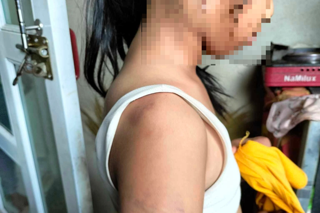 Chủ tịch huyện chỉ đạo xử lý nghiêm vụ nữ sinh lớp 4 bị 10 bạn đánh dã man - 3 Chủ tịch huyện chỉ đạo xử lý nghiêm vụ nữ sinh lớp 4 bị 10 bạn đánh dã man - 3