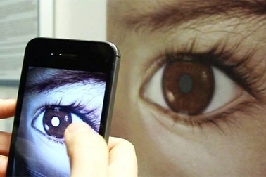 Các giai đoạn của ung thư võng mạc