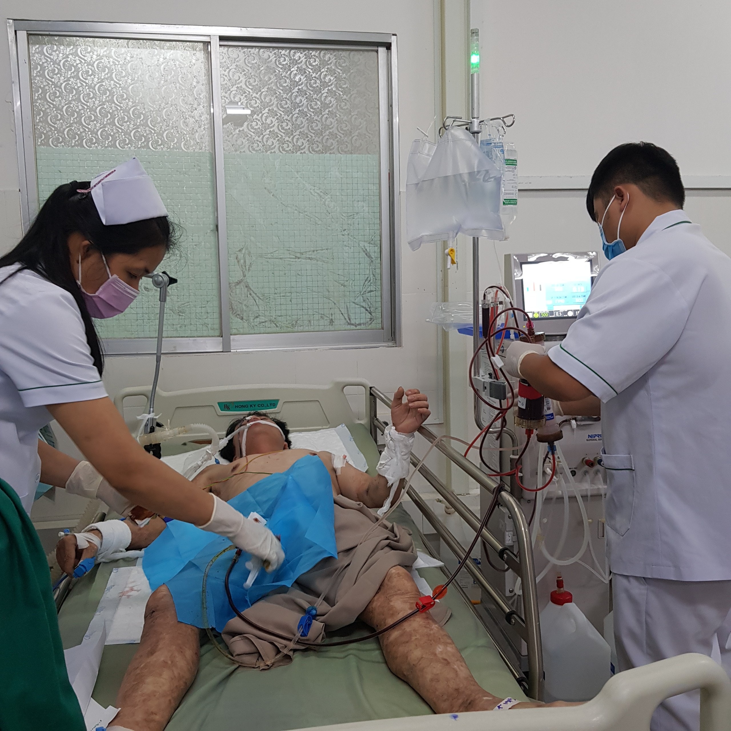 Liệt toàn thân, hôn mê sâu sau khi ăn dạ dày cá mặt thỏ
