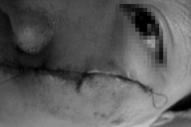 Cháu bé co giật bất thường sau khi bị đánh bằng xẻng tại mái ấm ở TPHCM