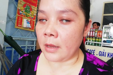 Mẹ khiếm thị nuôi con tiền ung thư.