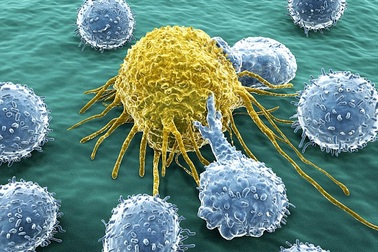 Vì sao người có lối sống lành mạnh vẫn bị ung thư?