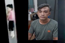 Giám định thương tật bé gái bị bạn trai của mẹ đập đầu vào tường