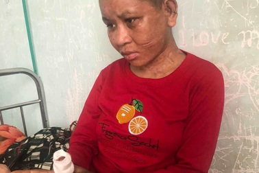 Chủ tịch tỉnh Gia Lai chỉ đạo "hỏa tốc" điều tra vụ một phụ nữ bị tra tấn man rợ