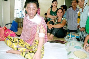 Nỗi đau tận cùng của người phụ nữ có ông chồng ác thú