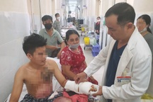 Bác sĩ vượt "bão" đấu thầu, đem máy tiền tỷ về cứu bệnh nhân bỏng nặng