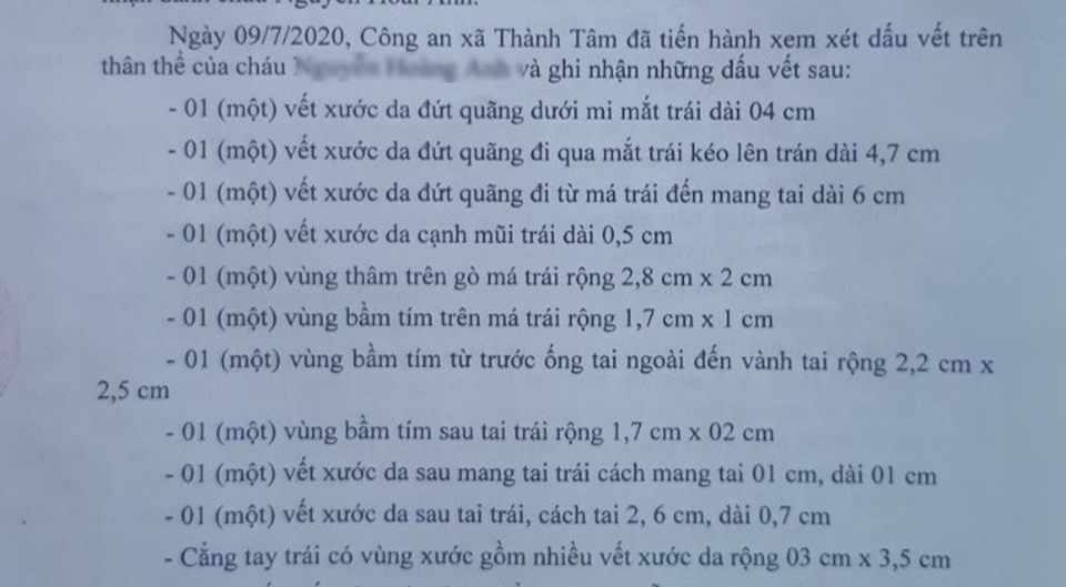 Phụ huynh tố cô giáo đánh bé gái 30 tháng tuổi bị thương - 2 Phụ huynh tố cô giáo đánh bé gái 30 tháng tuổi bị thương - 2