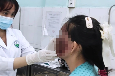 Hàng chục ca tai biến làm đẹp đón Tết: Em giúp tiêm filler, chị suýt mù mắt