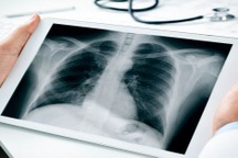 Ung thư phổi có phẫu thuật được không?