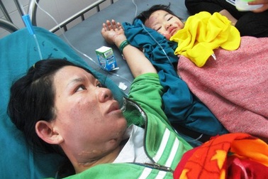 Bồng con nấu ăn, 2 mẹ con bị bỏng nặng