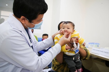 Hành trình tìm lại nụ cười cho hơn 100 trẻ sứt môi, hở hàm ếch