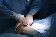 TPHCM: Cô gái 26 tuổi nguy kịch sau đặt túi ngực, nhổ răng khôn ở bệnh viện