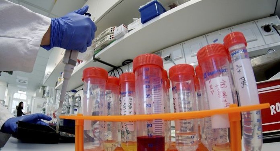 Nhật Bản sẽ thử nghiệm lâm sàng thuốc điều trị HIV cho virus corona - 1