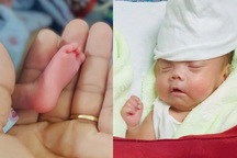 81 ngày sinh tử của 2 em bé "cực non" mắc hội chứng truyền máu song thai