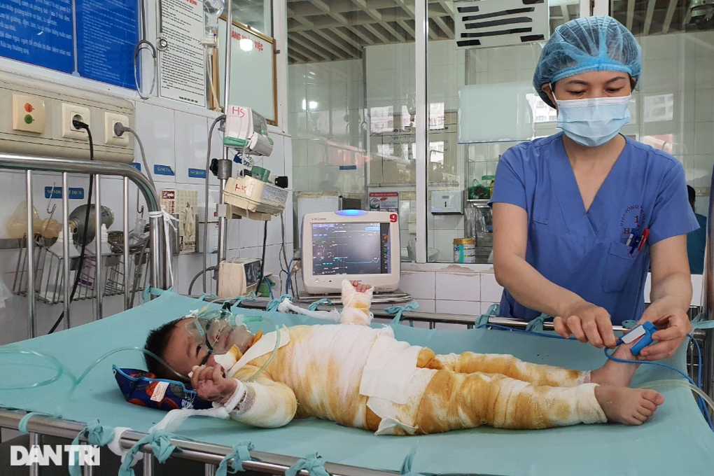 Bỏng nước sôi 66% cơ thể, bé 20 tháng tuổi nguy kịch xin cứu tính mạng - 1 Bỏng nước sôi 66% cơ thể, bé 20 tháng tuổi nguy kịch xin cứu tính mạng - 1