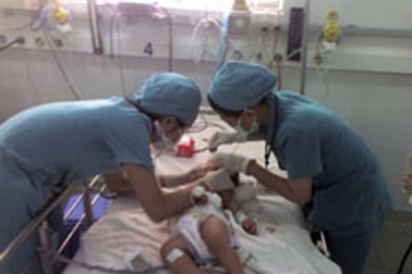 Một trẻ 9 tháng tuổi bị sốc sốt xuất huyết nặng