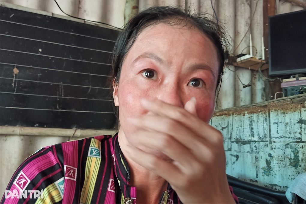 Nữ sinh tuổi 20 phải cắt một chân khi bao ước mơ còn dang dở - 3 Nữ sinh tuổi 20 phải cắt một chân khi bao ước mơ còn dang dở - 3