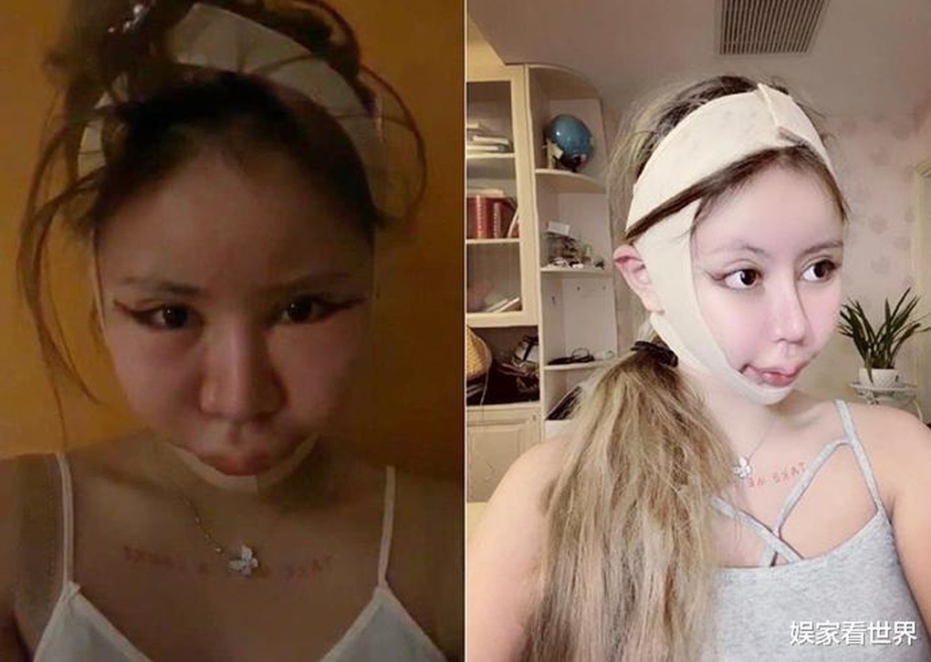 Cha mẹ đầu tư cho con phẫu thuật thẩm mỹ, liệu có đúng đắn? - 5 Cha mẹ đầu tư cho con phẫu thuật thẩm mỹ, liệu có đúng đắn? - 5