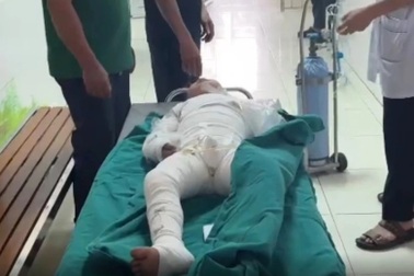 Nghe tiếng khóc, mẹ chạy về thấy con như ngọn đuốc sống