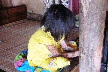 "Bé gái mơ một ngày được làm thiếu nữ" nhận quà bạn đọc   