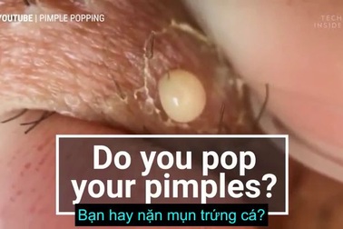 Cách để nặn mụn đúng nhất