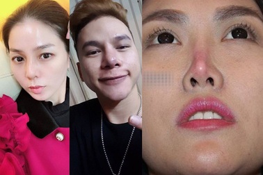 Những sao Việt gặp “hạn” vì “dao kéo”, cấy “đồ giả” vào người