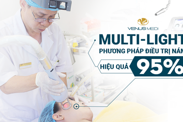 Multi Light – Bước ngoặt đột phá trong điều trị nám