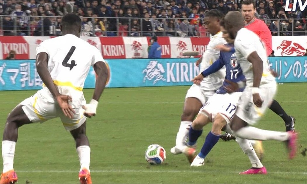 Tuyển thủ Nhật Bản sút gãy chân ngôi sao Ghana - 1