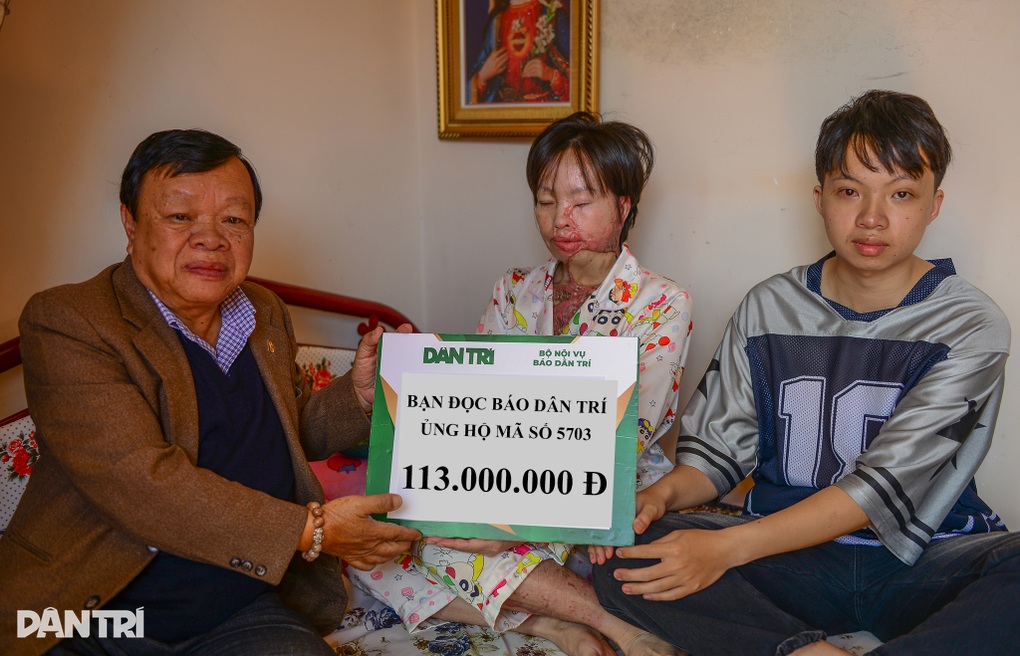 Bạn đọc hỗ trợ người phụ nữ bị bỏng axit ở Lâm Đồng 176 triệu đồng - 1 Bạn đọc hỗ trợ người phụ nữ bị bỏng axit ở Lâm Đồng 176 triệu đồng - 1