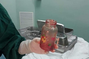 Nhét bình sữa vào hậu môn để... chữa thoái hóa cột sống