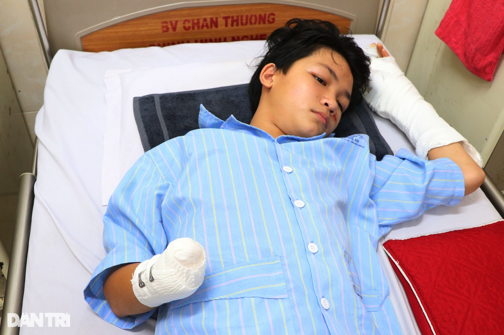 Bé trai 14 tuổi mất bàn tay sau tiếng nổ xé tai, bố nghẹn ngào nghe con hỏi - 1 Bé trai 14 tuổi mất bàn tay sau tiếng nổ xé tai, bố nghẹn ngào nghe con hỏi - 1