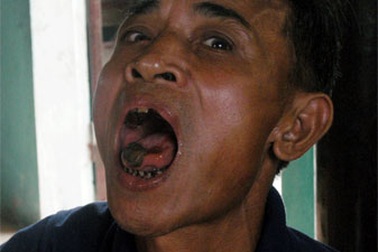 Chuyện khó tin về người ăn gan, mật cóc tươi