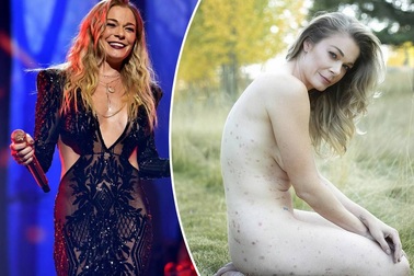 Nữ ca sĩ khỏa thân để nâng cao nhận thức của cộng đồng