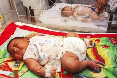 Kỷ lục mới tại Ấn Độ: Một em bé sơ sinh có cân nặng gần 6kg