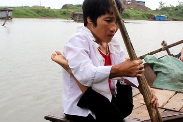 Cuộc sống của người phụ nữ có đôi chân hình chữ V