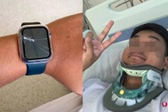 Apple Watch cứu mạng chủ nhân bị thương nghiêm trọng sau tai nạn giao thông