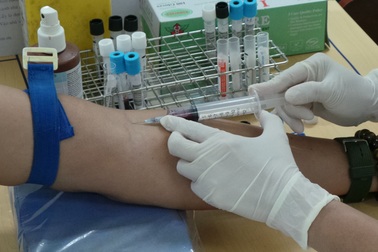 Bệnh nhân 30 năm nhiễm HIV, vẫn sống khỏe mạnh