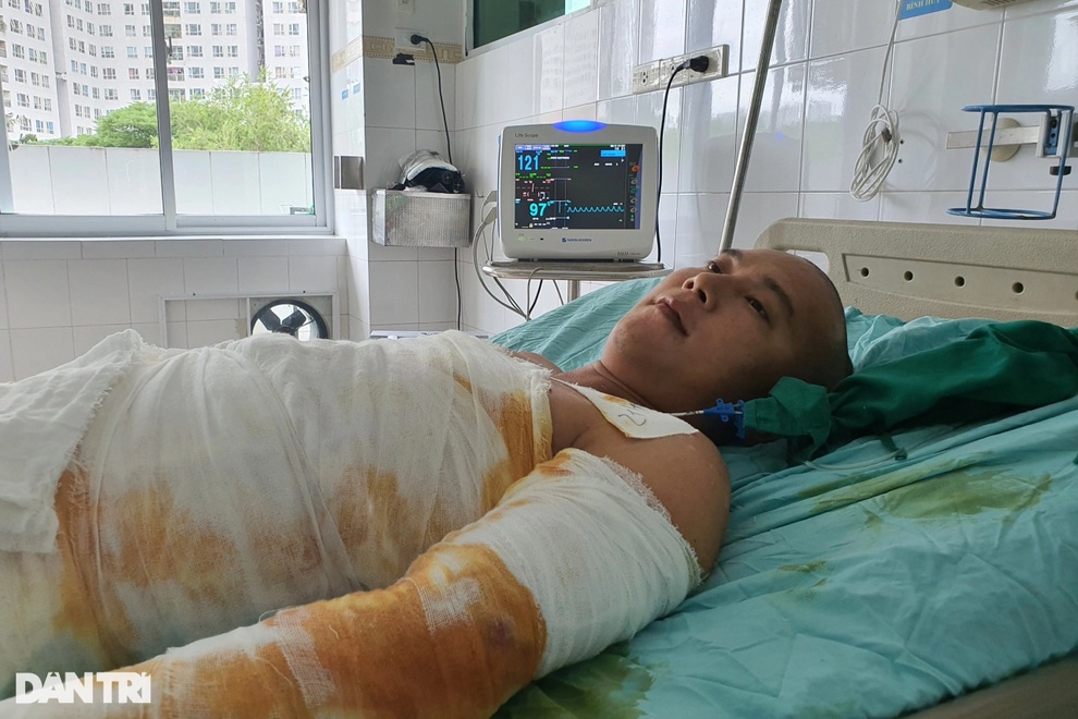 Người đàn ông bị bỏng điện được bạn đọc Dân trí giúp đỡ hơn 102 triệu đồng - 2 Người đàn ông bị bỏng điện được bạn đọc Dân trí giúp đỡ hơn 102 triệu đồng - 2