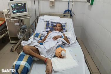 Nhiễm vi khuẩn đặc biệt, người bố 3 con phải cắt bỏ chân 6 lần