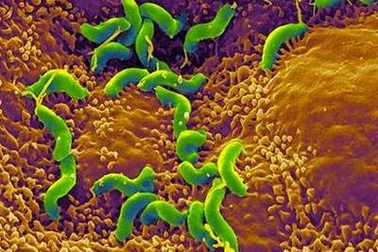 Loại bỏ khuẩn HP, giảm thiểu nguy cơ ung thư dạ dày