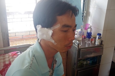 Đang làm nhiệm vụ, Phó Công an xã bị côn đồ chém lìa tai