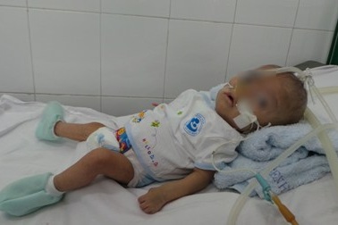 Bé trai 9 tháng tuổi có trái tim nằm bên phải