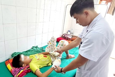 Bé 13 tuổi bị dập 2 bàn tay, rách giác mạc do nghịch pin