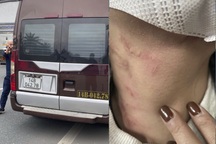 Chưa liên lạc được với nữ hành khách "tố" bị nhà xe bóp cổ, bỏ rơi