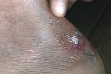 Nghệ An: Hoang mang hàng trăm người bị “bệnh lạ”