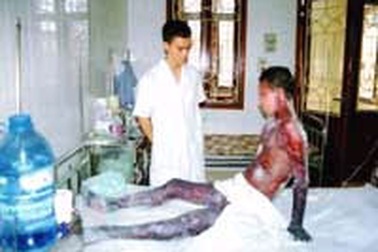 Dị ứng thuốc đông y - Tai họa khôn lường