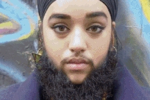 Cô gái có bộ râu quai nón chật vật kiếm việc, khó tìm được người yêu